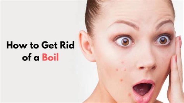 Why do boils smell when burst?