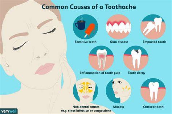 Why does a toothache hurt my ear?
