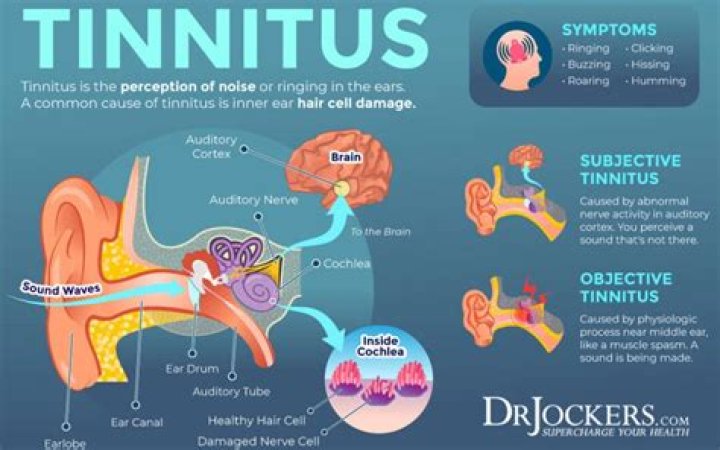 Why does tinnitus increase when lying down?