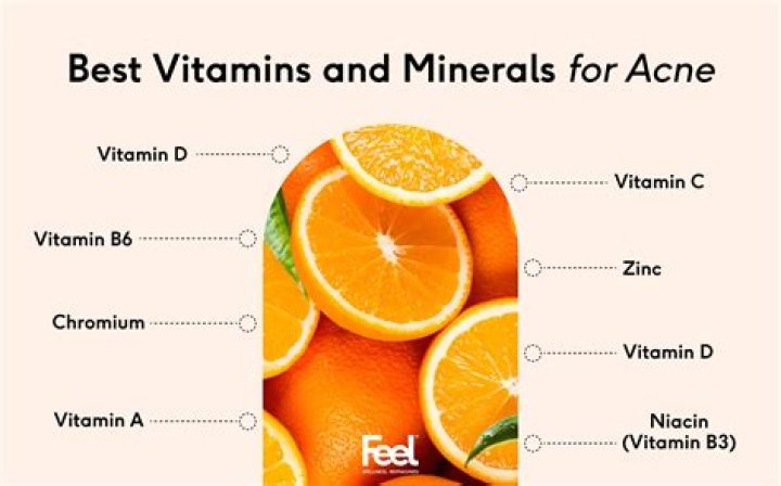 Will vitamin A help with acne?